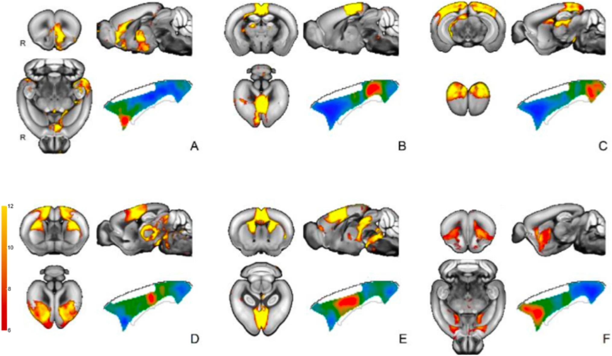 Human Cingulate Cortex